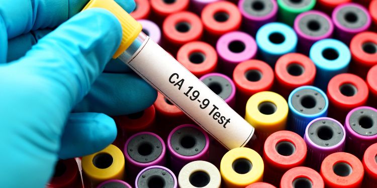 test marker tumore stomaco